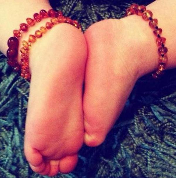 What's an amber teething anklet, teething bracelet or necklace? 2025